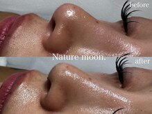 ナチュールムーン(Nature moon.)/毛穴洗浄