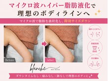 オリエンタルローザ 表参道(Oriental Rosa)/最先端痩身術！脂肪液化でポイ！