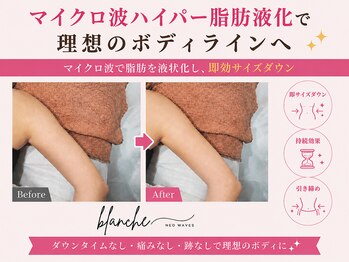 オリエンタルローザ 表参道(Oriental Rosa)/最先端痩身術！脂肪液化でポイ！