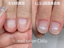 クレル(Clelu)の雰囲気（深爪に悩まれている方、ぜひ一度ご相談ください。）