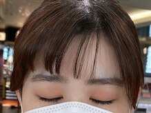 ビューティーガーデン イース/BEFORE