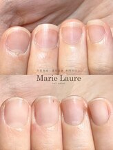 マリーロール 梅田店(Marie Laure)/自爪育成/深爪矯正/ネイルケア