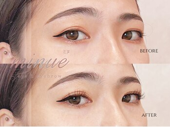 レイズ(RAISE)/フラットラッシュ上両目