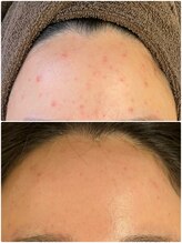 美顔研究所 バイ ヴィヴセカンド(美顔研究所 by viv 2nd)/