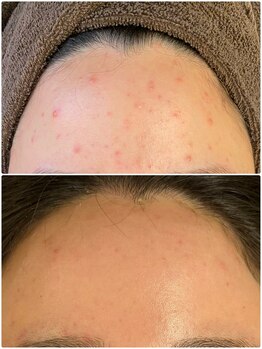 美顔研究所 バイ ヴィヴセカンド(美顔研究所 by viv 2nd)/