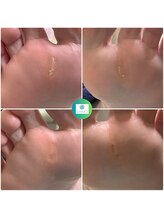 リゼラアンドコー たまプラーザ店/フットキュアコース