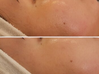 エントテ(en to Te)/リピート確実!引締め&透感UP