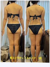 ナチュラルビューティーラボ(Natural Beauty Labo+)/体型改善pirates＋痩身エステ