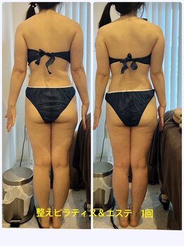 ナチュラルビューティーラボ(Natural Beauty Labo+)/体型改善pirates＋痩身エステ