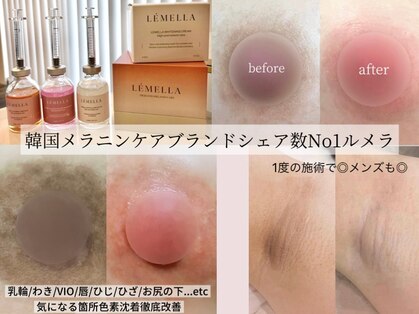 ルナベル(Luna Bell)の写真