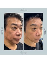 モア(eyelash salon MOOR)/【エクソリフト】