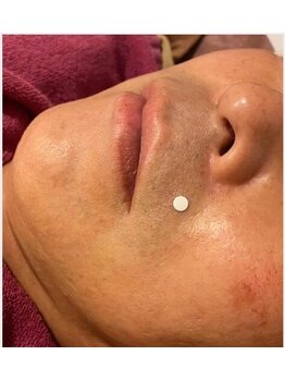 レイール(Reir)の写真/【人気のメンズ脱毛】脱毛で毛もお手入れの負担もなくしましょう☆ プチエステ付き¥6,800