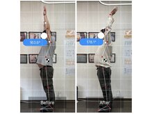 エモアメディカル整体院 麻布十番(Emoaメディカル整体院)/【40代男性】両側肩痛