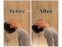 整体ラルース 中目黒(LALUZ)/30代 男性 ストレートネック改善