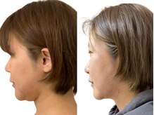 ハッテンビューティーパーク 神戸店(Hatten Beauty Park 810)