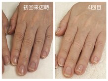 キレイテ 上野店/50代/4回目【ハンドケア稲荷町】