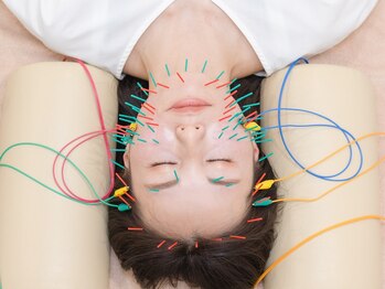 ピアーズ鍼灸整骨院の写真/大人女性の肌質を整える美容鍼なら烏丸御池の当サロンで。リフトアップも◎
