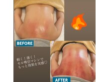 プライベートサロン ノエル(Noel)/ダイエット