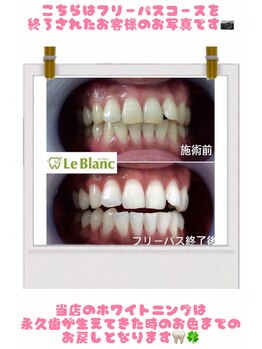 ルブラン 奈良店(Le Blanc)/本来の歯のお色に！
