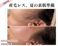 アイリスビューティーサロン(iRiS Beauty salon)