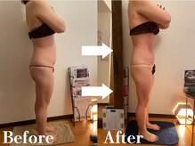 ディオネの雰囲気（くびれ、大転子の出っ張り改善、ヒップUP効果◎）