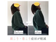 整体あゆむ 立川店/before after10