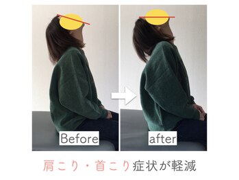 整体あゆむ 立川店/before after10