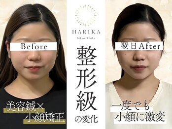 ハリカ 大阪心斎橋店(HARIKA)