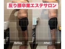 ラボ アビチュード(Labo Habitude)/反り腰(男性はご紹介のみです。)