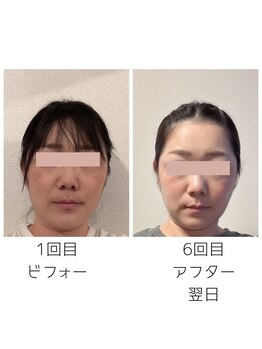 晴れ晴れ整体院/小顔になれる！