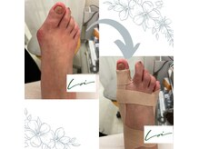 ロワの雰囲気(本場ドイツにてポドロジー・フスフレーゲ資格取得)