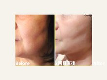 ヨガ アンド リラクゼーション からだの恵み 安城サロン/たるみ・むくみ速攻ケア