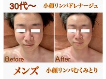 萬裡(マリン)の雰囲気（小顔リンパ・むくみ・たるみ改善・食いしばりに特化理想の小顔へ）