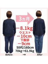 おもいやり鍼灸治療院 モーイ(mooi)/痩身体質ケアダイエット