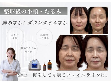 シェリー(Cherie)の写真