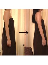 ビュール 銀座(BeauL)/ブライダルダルエステ♪二の腕