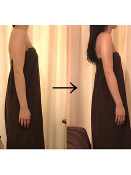 ビュール 銀座(BeauL)/ブライダルダルエステ♪二の腕