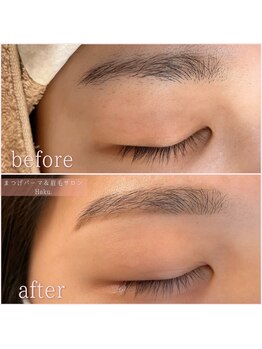ハク 倉敷店(Haku.)/【眉毛WAX脱毛】before・after