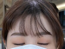 ビューティーガーデン イース/AFTER