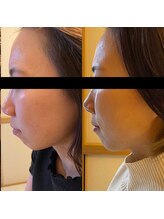 トータルビューティーサロンリア(Li'a)/ビフォー＆アフター