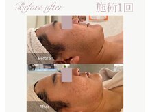 パルタージュ(Partage)/ハーブトリートメント