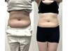 短期間で痩せたい方向けの全身痩身コース90分