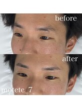 モテテ 名駅店(motete)/お客様施術例☆名駅