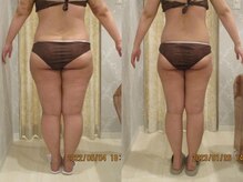 プロラボスパ 加古川店/30代前半　症例写真