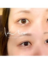 クレー(Klee)/ラッシュリフト