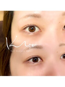 クレー(Klee)/ラッシュリフト