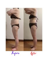 フランジパニ(Frangipani)/お腹集中ケアでスッキリ☆