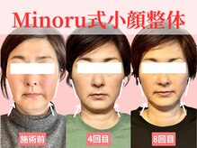 フレキシボディ(FlexiBody)の雰囲気(小顔矯正整体の回数を重ねる事で、より確実な小顔へ導きます!)