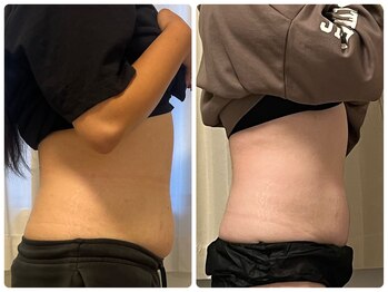 シャイン(SHINE)/