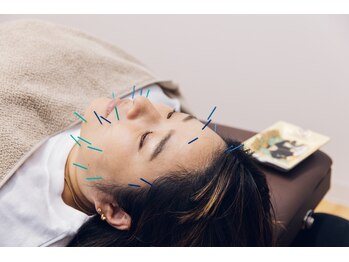 クガツヨッカの写真/美容鍼とヘッドスパ、小顔矯正の組み合わせ施術で小顔になりたいあなたへ。